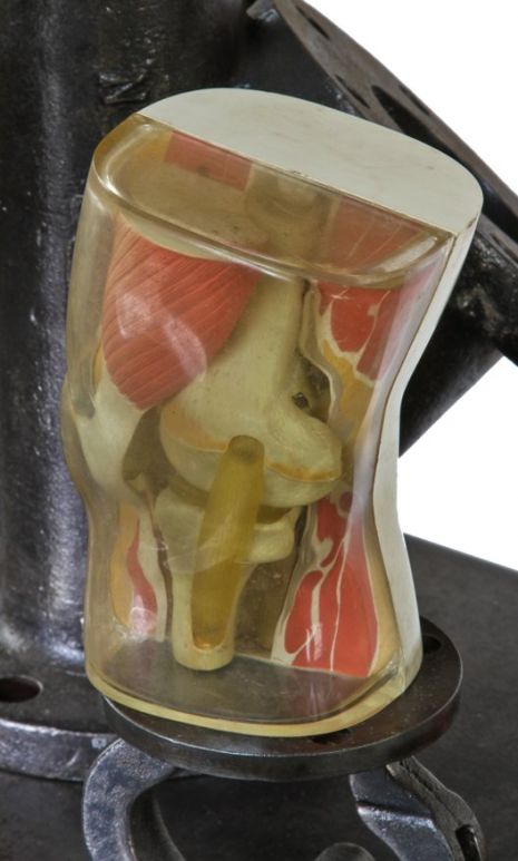 c. early 1960's american  vintage medical human muscled knee joint patient education anatomical model with outer shell molded in clear plastic